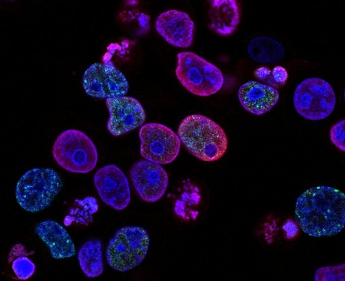 Cosa può trattare la medicina rigenerativa e i rischi legati alle cellule staminali da sapere
